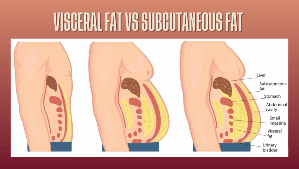 Cross-section diagram of skin layers highlighting subcutaneous fat just under the skin.
