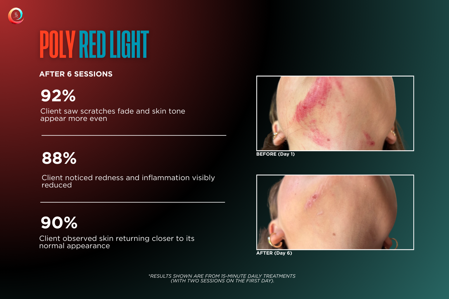Infrared Wellness Myrtle Beach: Infrared Facts vs. Marketing Myths