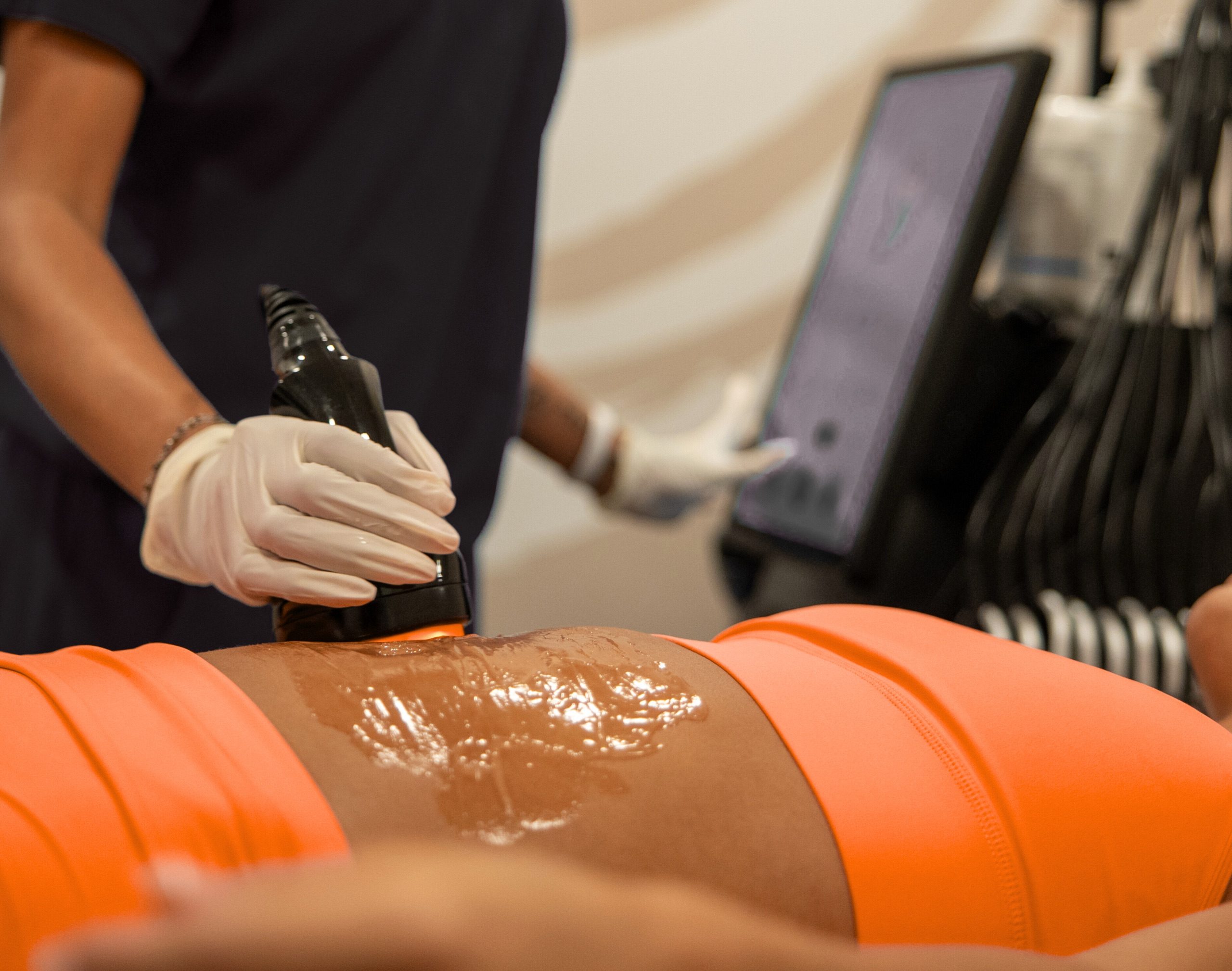 Cavitation_Client - Edited.jpg