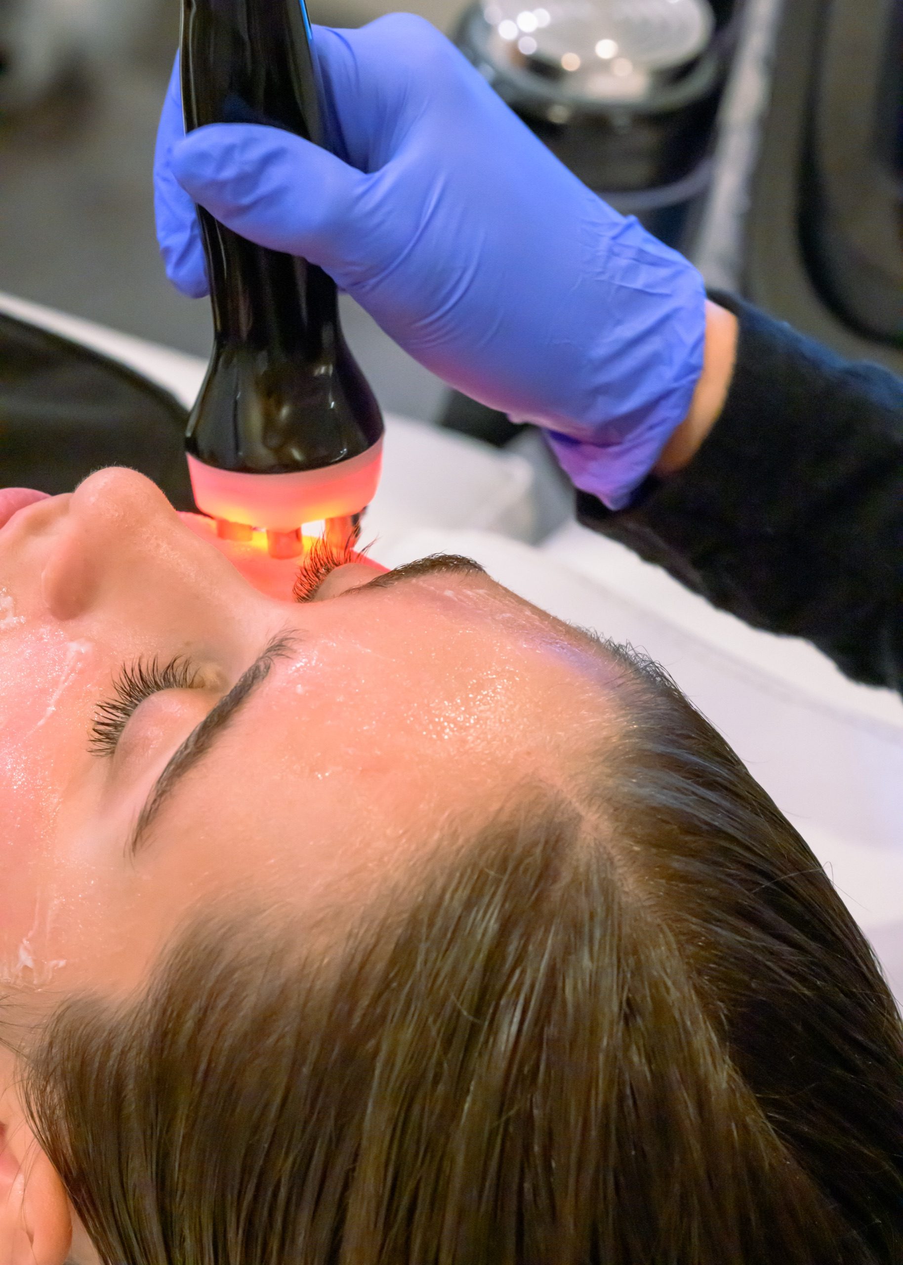 RF Face facial (6-Pole)- 11 - client